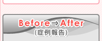 Before⇒After(症例報告) 四日市 インプラント 費用　ホワイトニング　治療